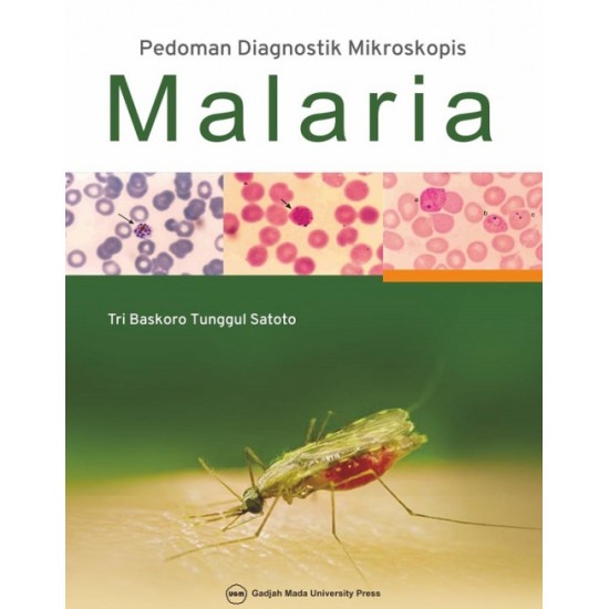 Pedoman Diagnostik Mikroskopis Malaria