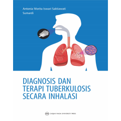 Diagnosis dan Terapi Tuberkulosis secara Inhalasi Diagnosis dan Terapi Tuberkulosis secara Inhalasi
